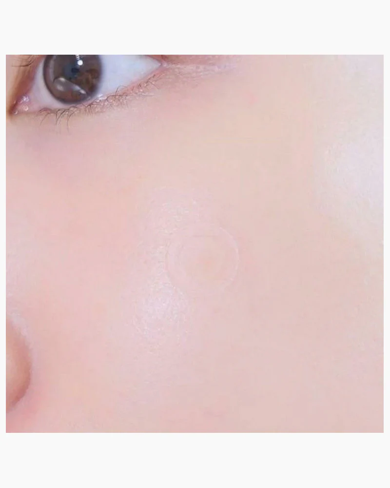 CARE PLUS Scar Cover Spot Patch - Image 4